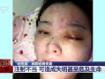 郑州医美爆料事件视频曝光