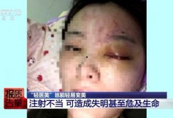 郑州医美爆料事件视频曝光