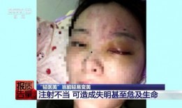 郑州医美爆料事件视频曝光